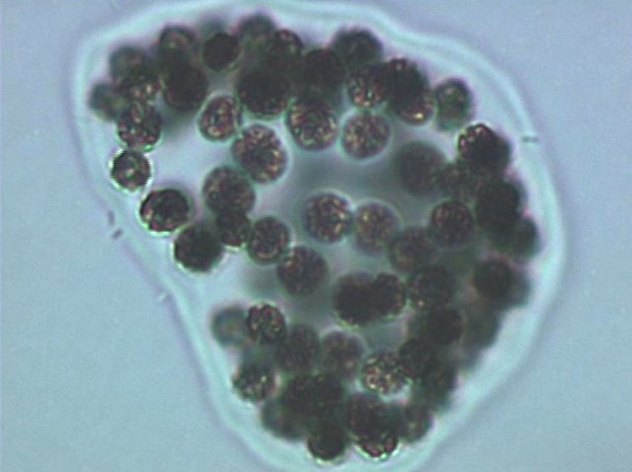Vue Microscope_Microcystis Wensebergii_@LucBrient